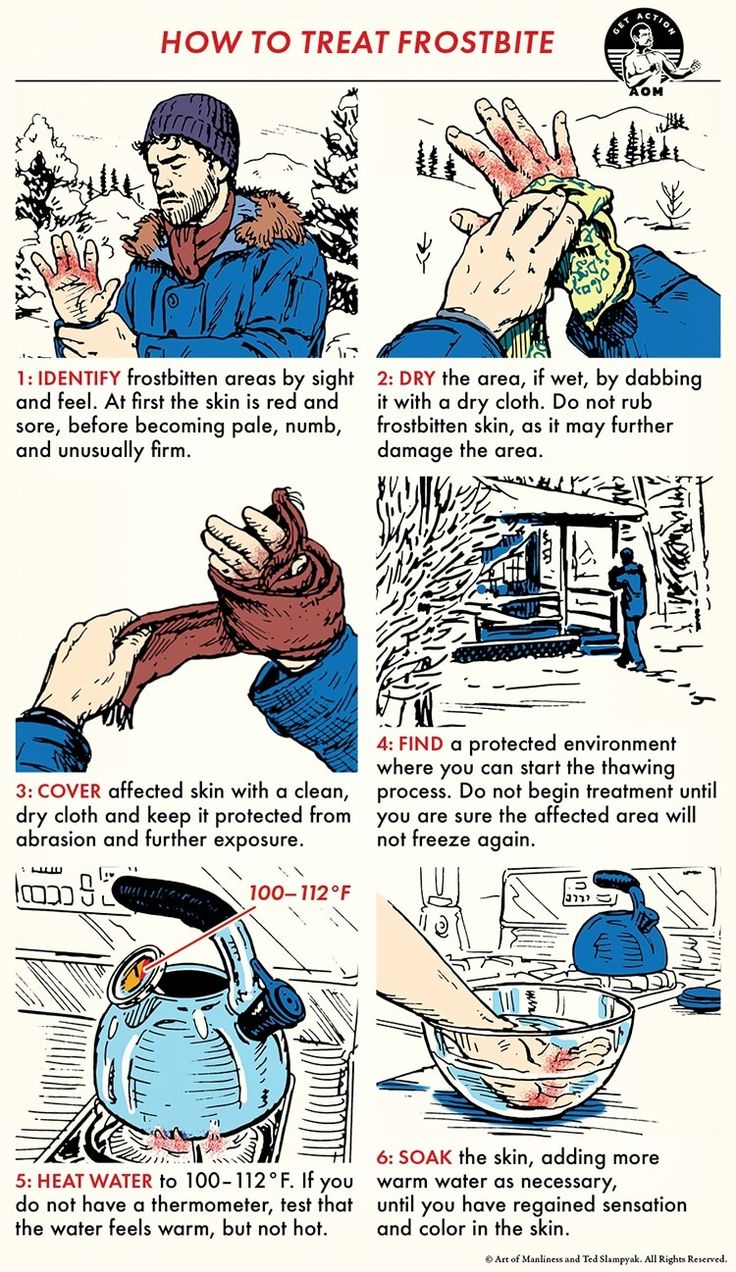 instructions on how to treat frosty hands