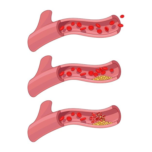 an image of blood cells in the human body set of three stages, one red and one yellow