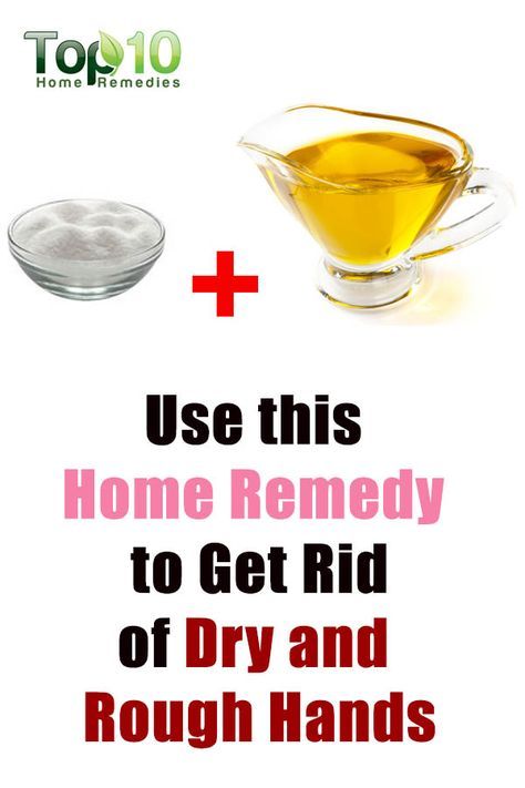 How To Make Hand Soft And Smooth, How To Make Your Hands Soft And Smooth, Soft Hands Routine, Dry Hands Remedy Overnight, How To Soften Hands, Cracked Hands Remedy, Dry Hands Remedy, Dry Skin Home Remedies, Extremely Dry Hands