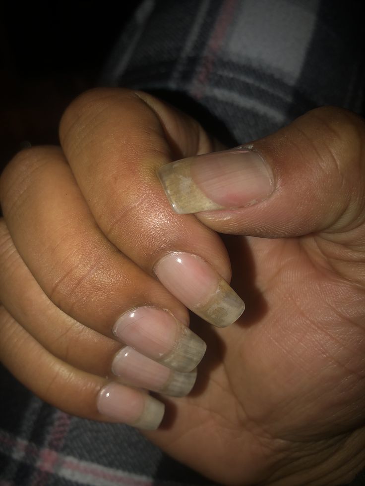 Clear acrylic overlay on natural nails Clear Natural Nails, Acrylic Overlay On Natural Nails, Overlay On Natural Nails, Clear Gel Nails, Clear Acrylic Nails, Acrylic Overlay, Nail Envy, Clear Nails, Clean Girl