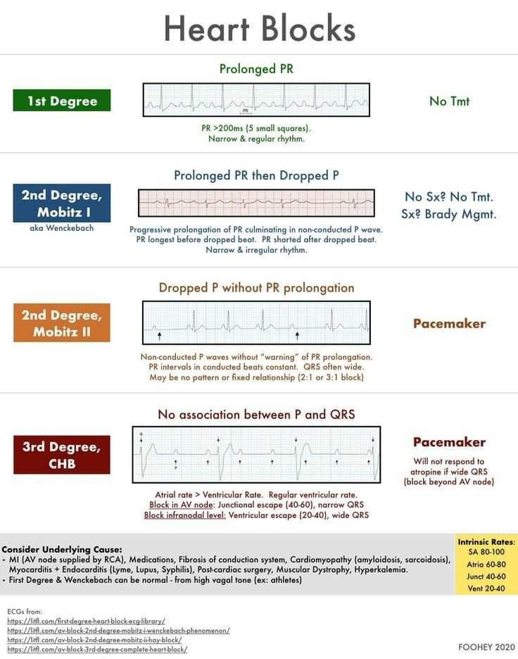 an image of the heart blocks chart