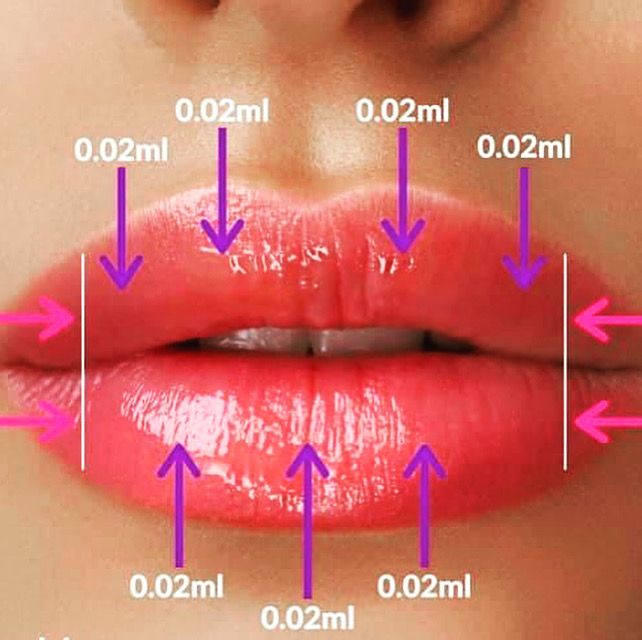 Dermal Fillers Lips, Derma Fillers, Lips Inspiration, Face Fillers, Botox Lips, Aesthetic Dermatology, Hyaluronic Acid Fillers, Facial Anatomy, Botox Face