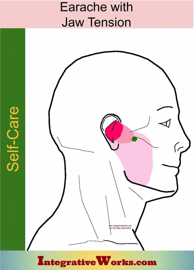 Lock Jaw Remedies, Masseter Muscle, Tmj Relief, Forward Head Posture Exercises, Anatomy Medical, Yoga Flows, Forward Head Posture, Jaw Pain, Trigger Point