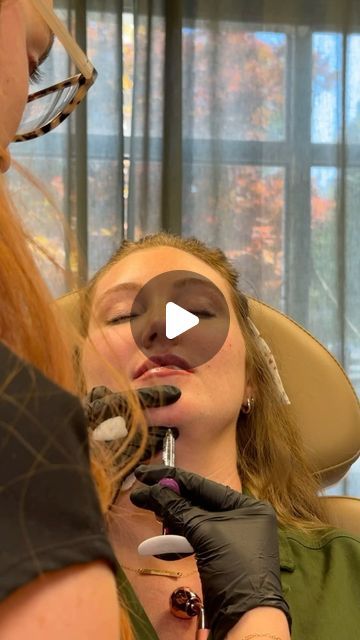 Jawline And Chin Filler, Facial Contouring Fillers, Face Balancing Fillers, Jawline Fillers Before And After, Improve Jawline, Cheek Fillers Before And After Face, Facial Balancing Filler, Chin Fillers Before After, Kayla Matthews