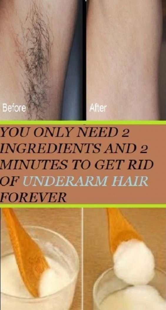 Best Permanent Hair Removal, Chin Hair Removal, Permanent Hair Removal Cream, Best Facial Hair Removal, Electrolysis Hair Removal, Chin Hair, Unwanted Hair Permanently, Unwanted Hair Growth, Underarm Hair Removal