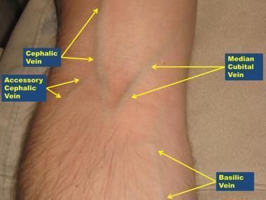 an arm with labels on it showing the location of vein