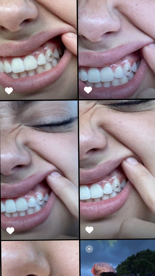 four different pictures of a woman's mouth and teeth