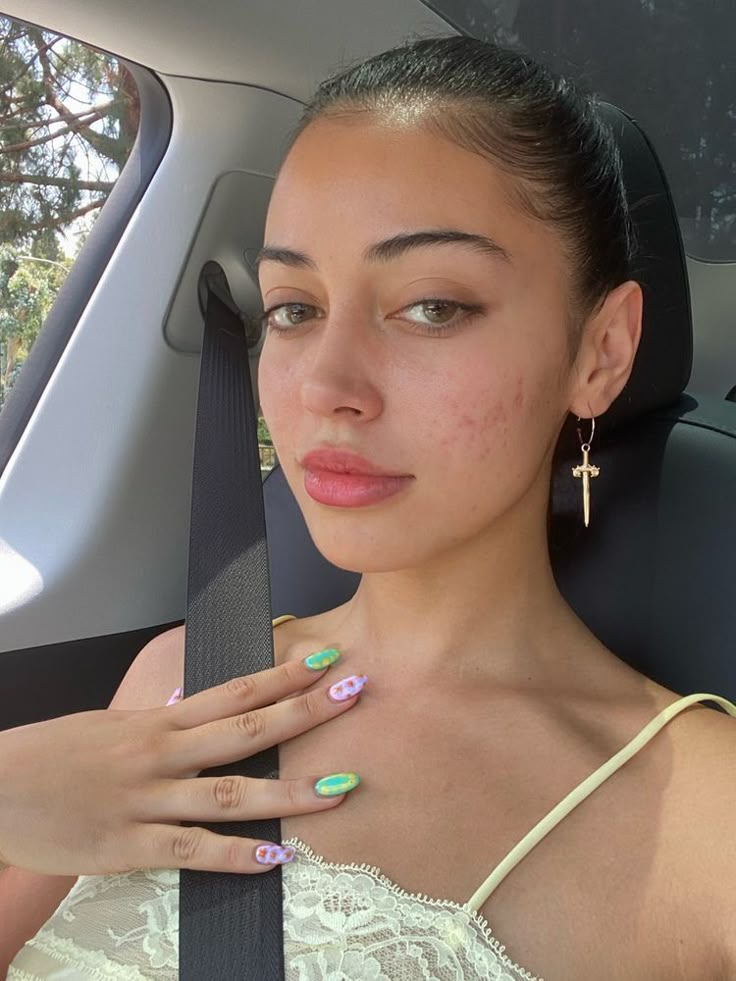 Girl With Acne, Marks Cream, Cindy Kimberly, Bare Beauty, Facial Skin Care Routine, Love Your Skin, Pretty Skin, Acne Marks, Without Makeup