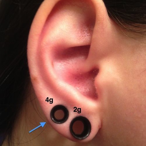 an ear with three black circles attached to the side of it, and two blue arrows pointing