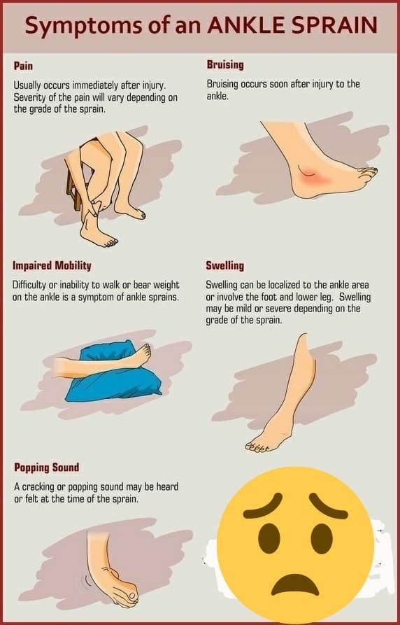 How To Wrap Sprained Ankle, How To Wrap An Ankle, Ankle Sprain Exercises, Ankle Ligaments, Ankle Exercises, Ankle Sprain, First Aid Tips, Physiotherapy Clinic, Ankle Pain