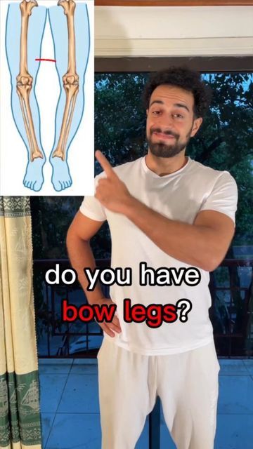 a man is pointing at his leg with the words do you have bow legs?