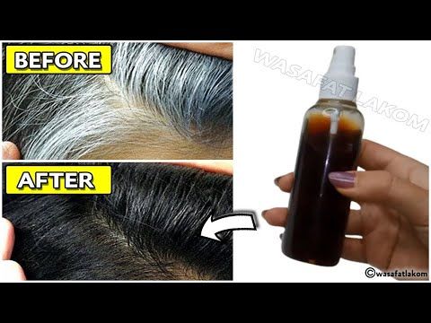 Grey Hair Natural Remedy, Grey Hair Home Remedies, Remove Gray Hair, Gray Hair Solutions, Anti Gray Hair, Natural Hair Dye, Black And Grey Hair, Silver Hair Highlights, Hair Mask For Growth