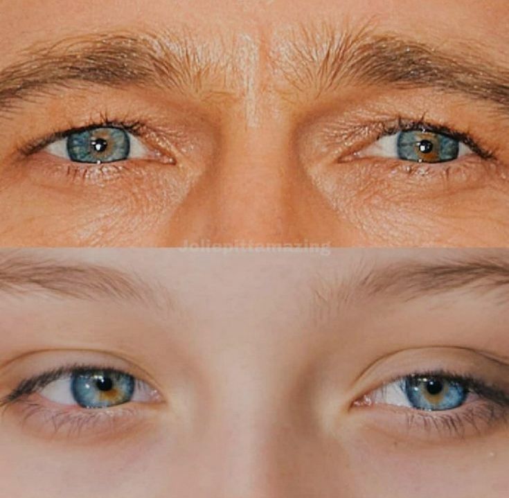 two different views of the same person's eyes, one with blue eyes and one without