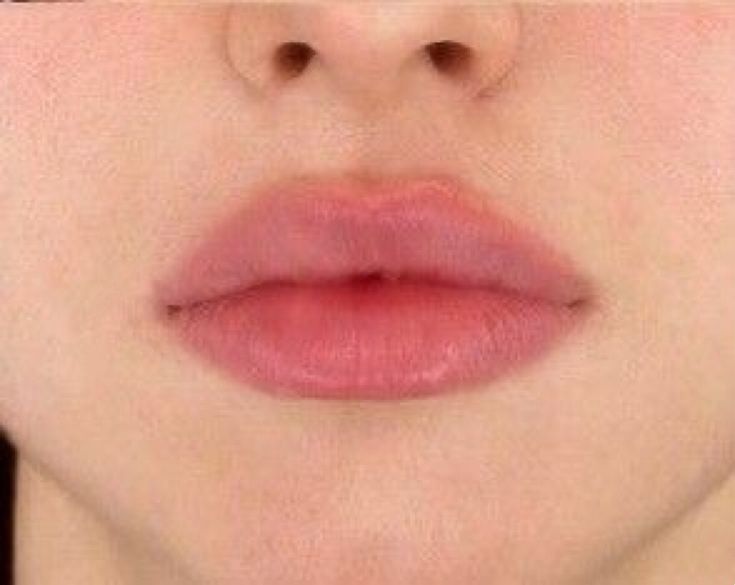 Lips Inspiration, Perfect Lips, Nose Job, Beauty Goals, Lip Fillers, Dream Body, Cute Makeup, Beauty Face, Makeup Inspo