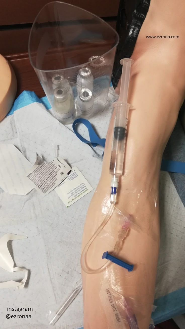 a person with an iv hooked up to their leg