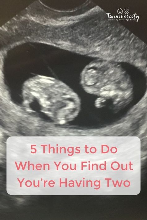 an x - ray with the words 5 things to do when you find out you're having two