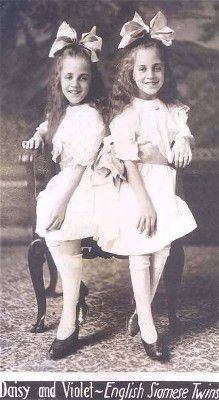 Violet and Daisy Hilton. Identical conjoined Siamese twins Daisy And Violet Hilton, Wikipedia Logo, Steampunk Circus, Circus Sideshow, Human Oddities, Conjoined Twins, Strange History, Vintage Circus, Vintage Portraits