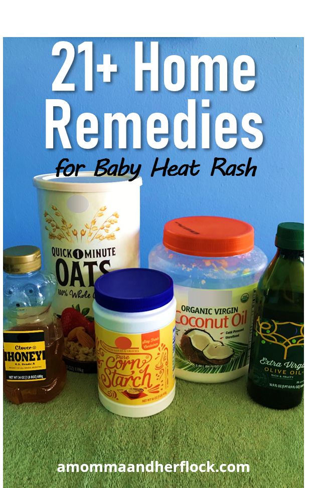 Learn how to treat baby heat rash. Heat rash usually only lasts a few days so here are some home treatments and remedies you can use to help baby's skin improve. Baby Heat Rash, Heat Rash Remedy, Rashes Remedies, Calamine Lotion, Hydrocortisone Cream, Soothe Sunburn, Heat Rash, Sick Remedies, Diy Beauty Products