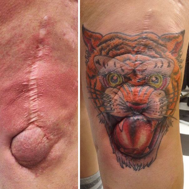 two pictures showing the scar on someone's leg and one with a tattoo that looks like a tiger