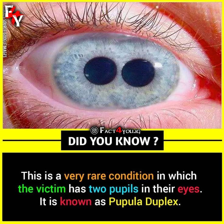 an eye with the words did you know?