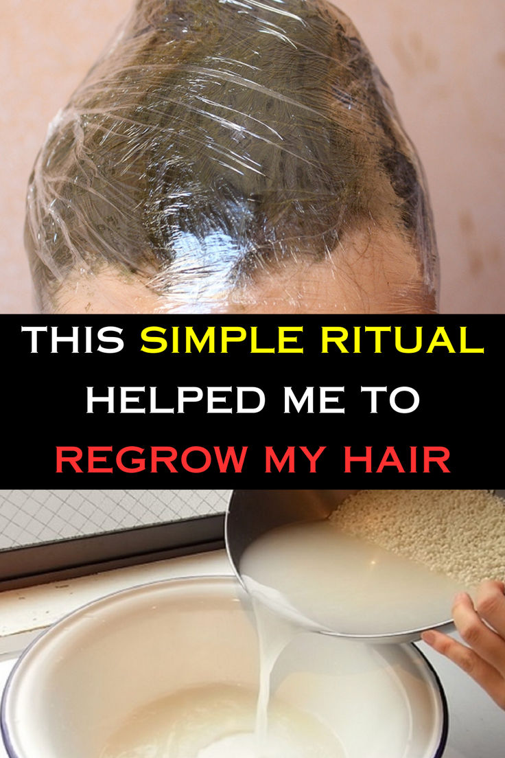 One of the most effective home remedies for hair growth may be a mixture of coconut oil and castor oil massaged into the scalp regularly. This natural blend nourishes the hair follicles, promotes circulation, and encourages healthy hair growth, resulting in thicker and stronger strands over time. #hair #healthyhair #regrowhair #balding #hairloss #thinninghair Chicken Cordon Bleu Casserole Recipe, Home Remedies For Hair Growth, Remedies For Hair Growth, Hair Growth Oil Recipe, Grow Eyelashes, Healthy Remedies, Hair Nutrition, Thicker Fuller Hair, Hair Things