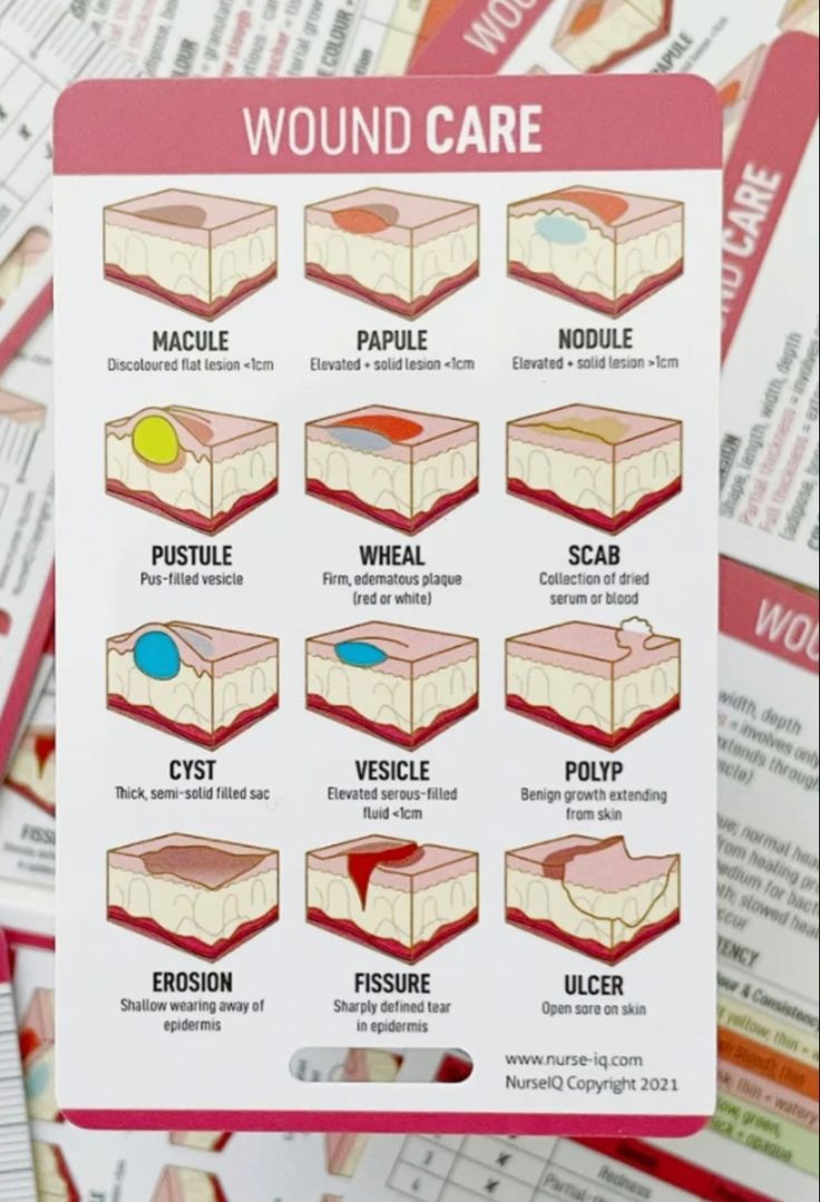 a close up of a sheet of paper with different types of wound care