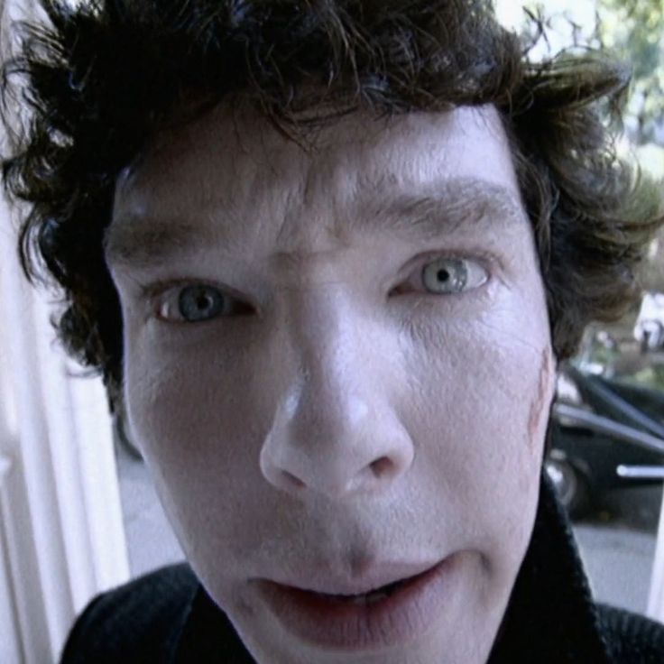 a close up of a person with freckles on his face looking at the camera