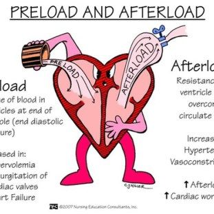 an info sheet describing the effects of preload and afterload in heart health care