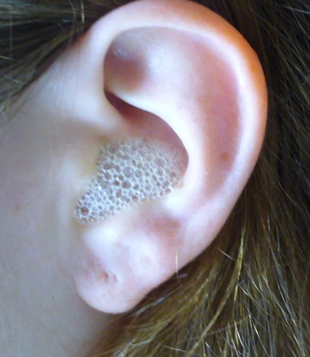 EAR SPA : 3 Steps (with Pictures) - Instructables Swimmers Ear, Peroxide Uses, 1000 Lifehacks, Hydrogen Peroxide Uses, Cleaning Your Ears, Dog Diy, Ear Infections, Ear Cleaner, Ear Wax