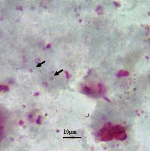 an image of some type of blood stained with purple and red dyes on it