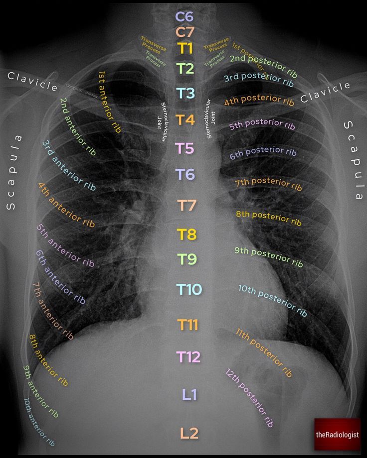 an x - ray shows the chest and lungs with words written in different languages on it