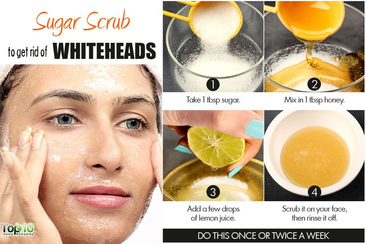 sugar scrub to remove whiteheads Remove Whiteheads, Whiteheads Remedy, Remedies For Acne, Hair Removal Diy, Exfoliating Face Scrub, Face Care Routine, Face Scrub Homemade, Learn Yoga, Acne Remedies