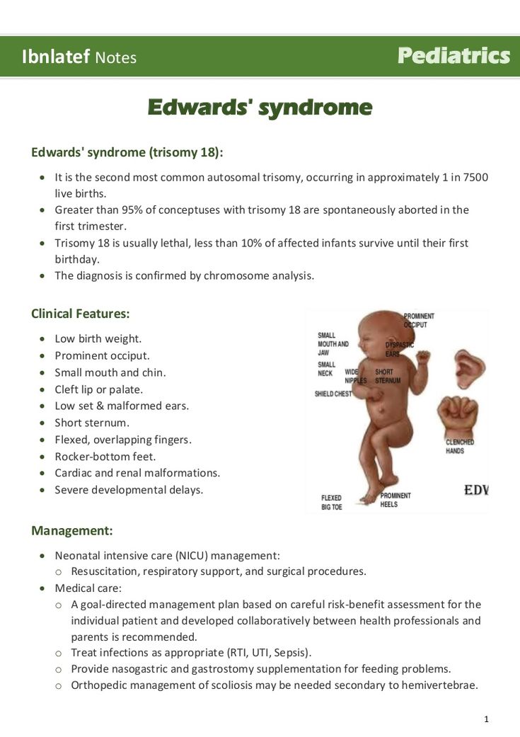 What Is Edwards Syndrome Or Trisomy 18 All You Need To Know Bellybelly ...