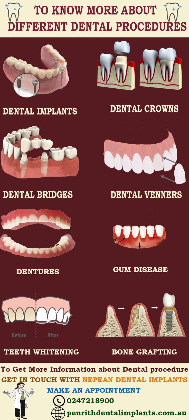 Dental Posters, Remedies For Tooth Ache, Dental Photography, Dentistry Student, Sedation Dentistry, Dental Facts, Implant Dentistry, Restorative Dentistry, Dental Bridge