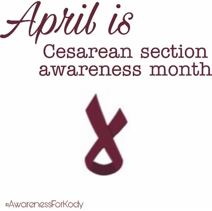 #CSection #CesereanSection #AprilIsCSectionAwareness C Section Awareness Month, Cesarean Section, C Section, Parenting 101, Parenting, Art