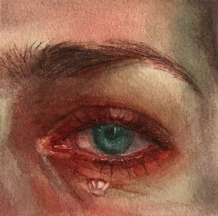 a close up of an eye with blood on it