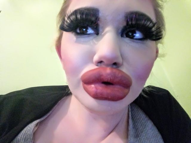 Woman Quadruples Her Lips To Have ‘Biggest In The World’ Huge Lips Injections, Huge Lip Fillers, Full Lips Natural, Full Makeup Looks, Full Lips Makeup, Overlined Lips, Pout Face, Funny Lips, Big Eyelashes