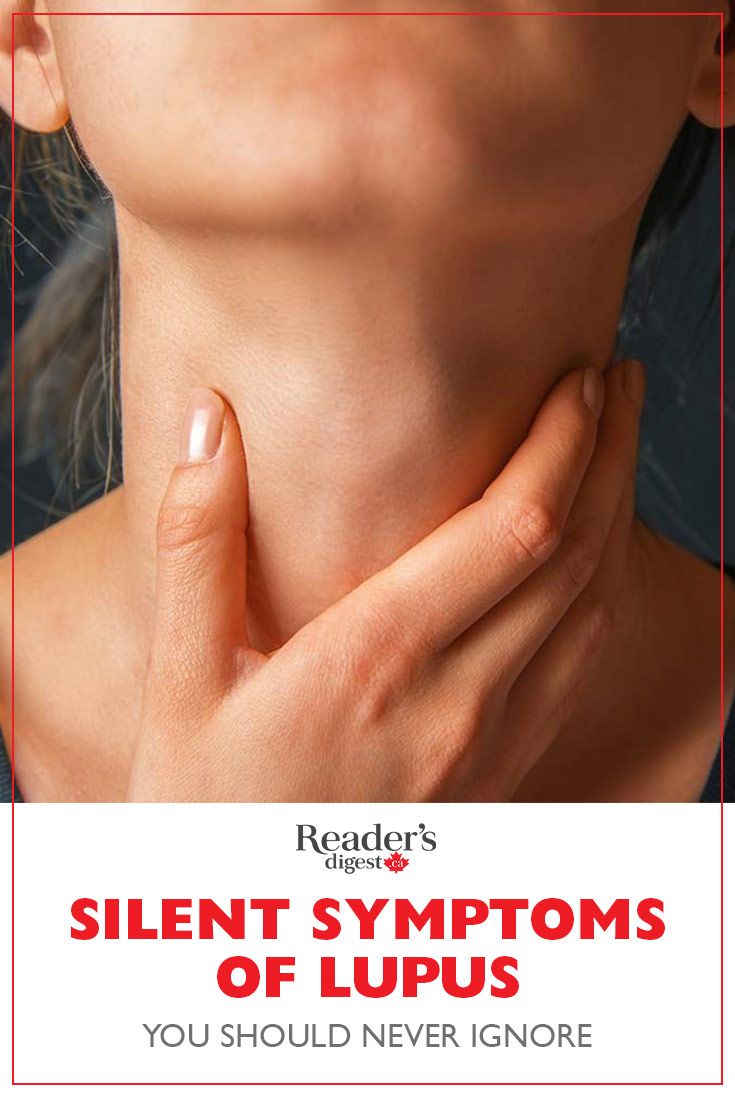 Autoimmune Disease Quotes, Autoimmune Disease Awareness, Autoimmune Disease Symptoms, Disease Quote, Invisible Disease, Sjogrens Syndrome, Disease Symptoms, Autoimmune Disorder, Thyroid Health