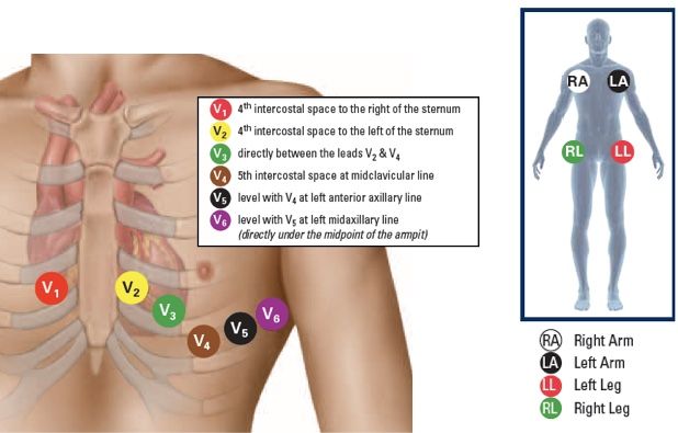 an image of the chest with labels on it