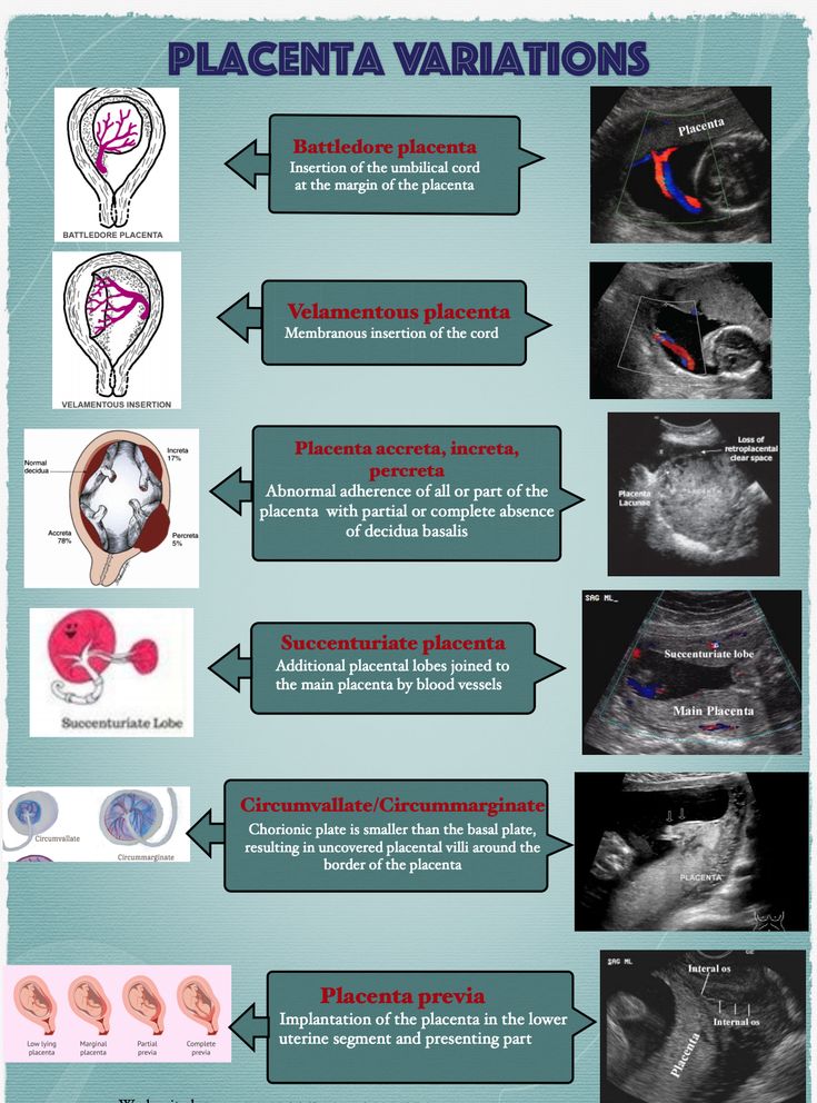 placenta  ultrasound Ultrasound Notes Study, Sonography Notes Ultrasound, Diagnostic Medical Sonography Student Notes, Sonography Student Notes, Ultrasound Technician Notes, Ultrasound Technician Aesthetic Notes, Black Ultrasound Technician, Ultrasound Technician Student Notes, Ultrasound Tech Notes