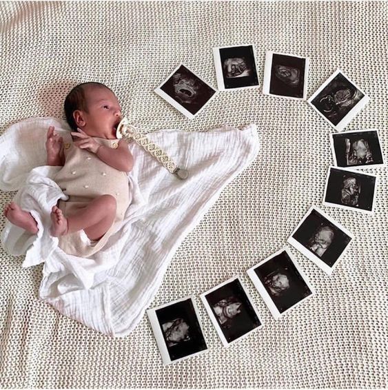 a baby laying on top of a white blanket next to many black and white photos