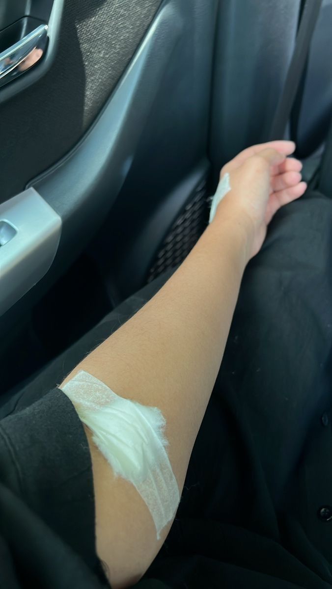 a person with bandages on their arm sitting in a car