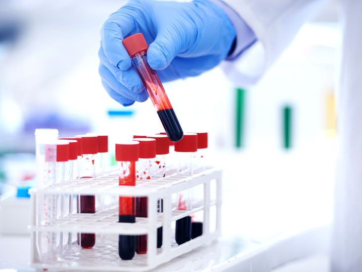 a person in blue gloves is holding a tube with red liquid and test tubes filled with blood