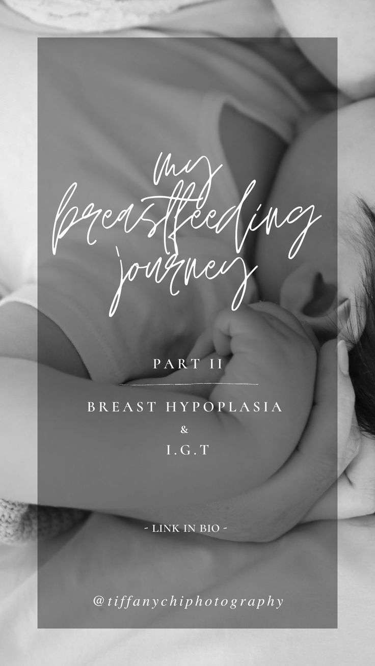 the breastfeeding journey part 11 breast hypplasia & c e t