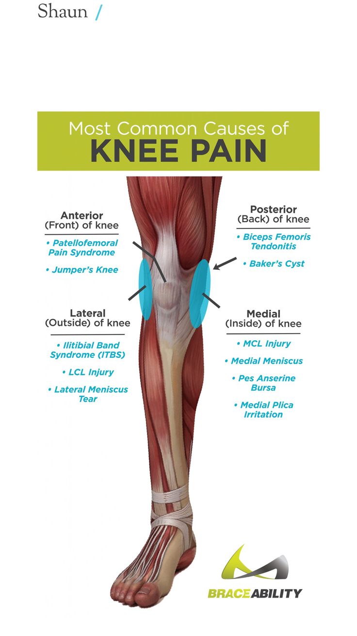 Knee Anatomy, Bursitis Knee, Patellofemoral Pain Syndrome, First Aid Training, First Aid Cpr, Body Chart, Rehabilitation Exercises, Pain Relief Remedies, Body Action