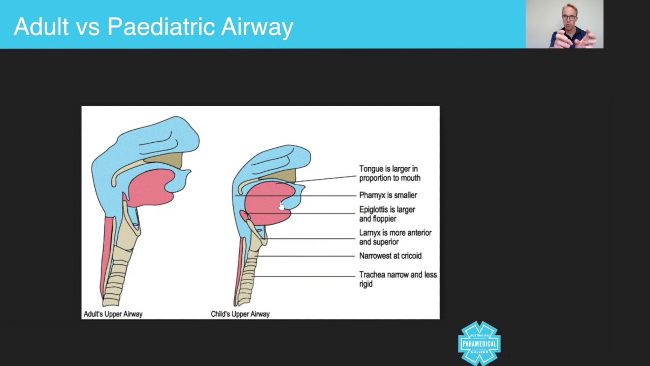 Adult Versus Paediatric Airway - Australian Paramedical College - YouTube