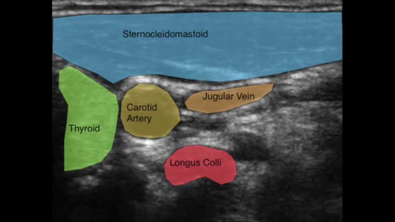 Neck Anatomy Ultrasound