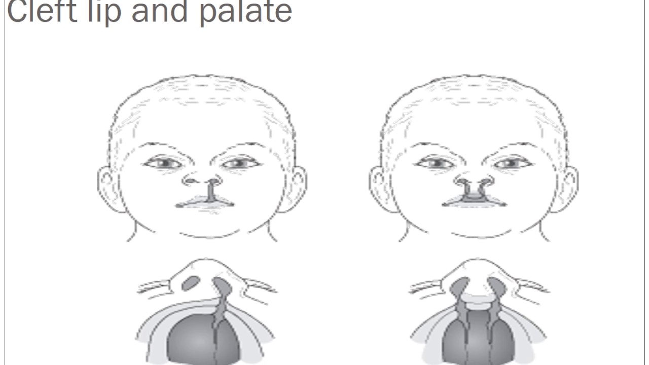 Pediatric Ear Examination - YouTube