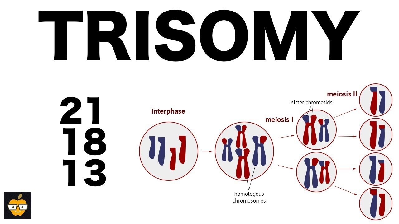 Trisomy: What Is, Causes, and The Most Common Trisiomies