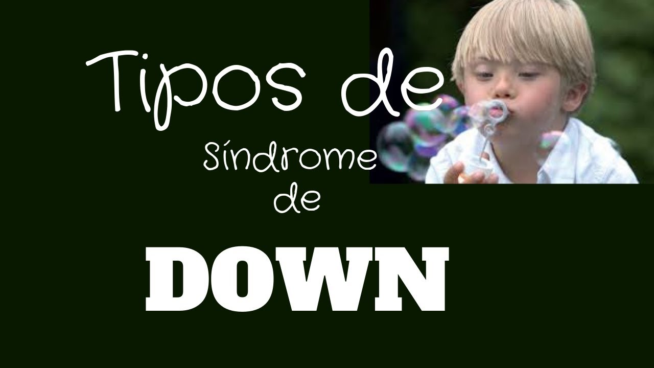 caracteristicas del sindrome de down